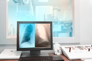 Computer screen showing digital x-ray images in front of a large window looking onto X-ray equipment