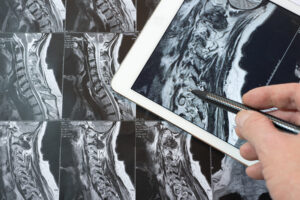 X-ray images of spinal area